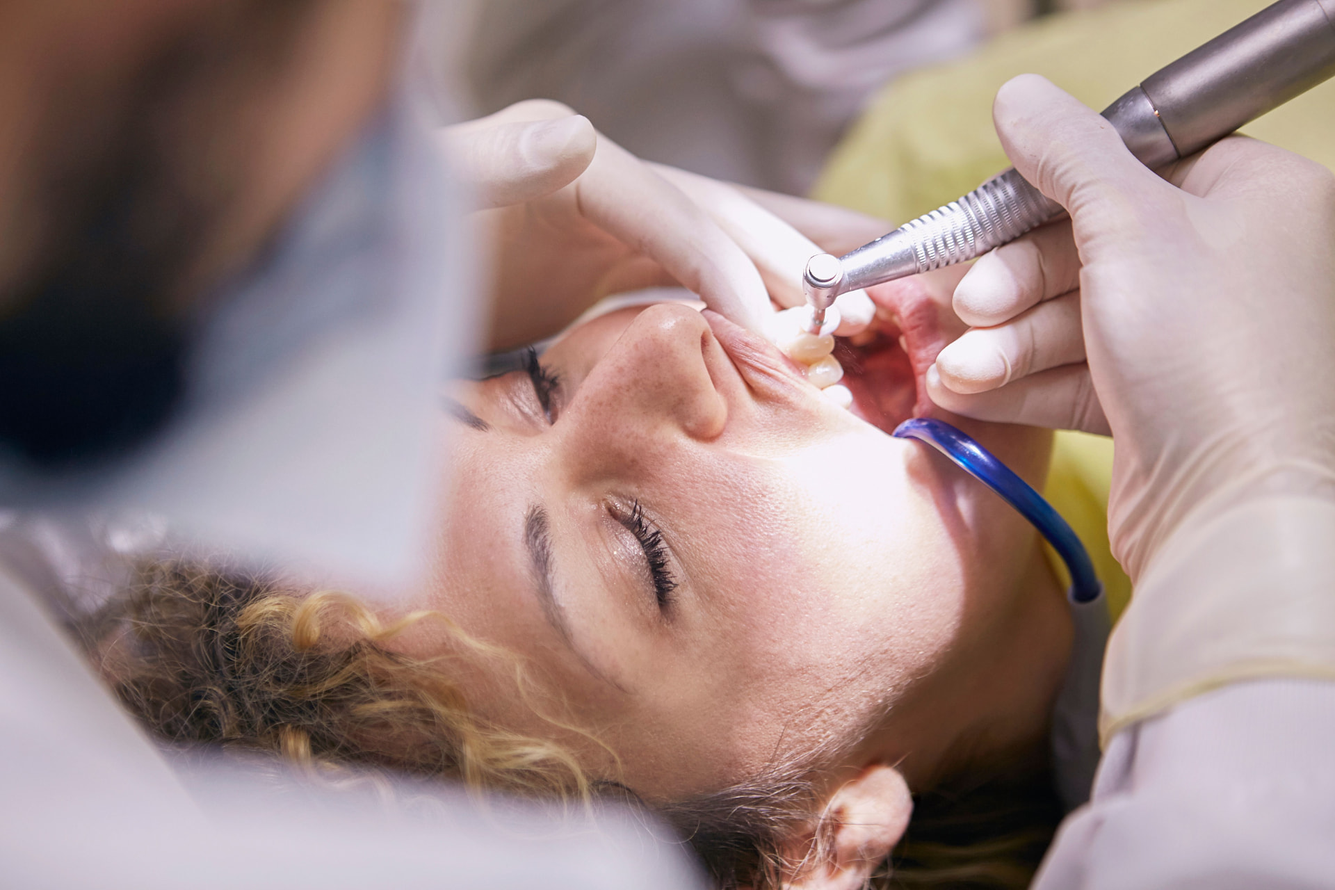 Dentist providing gentle care - Tooth Extraction at Westmount Dental in Waterloo, ON