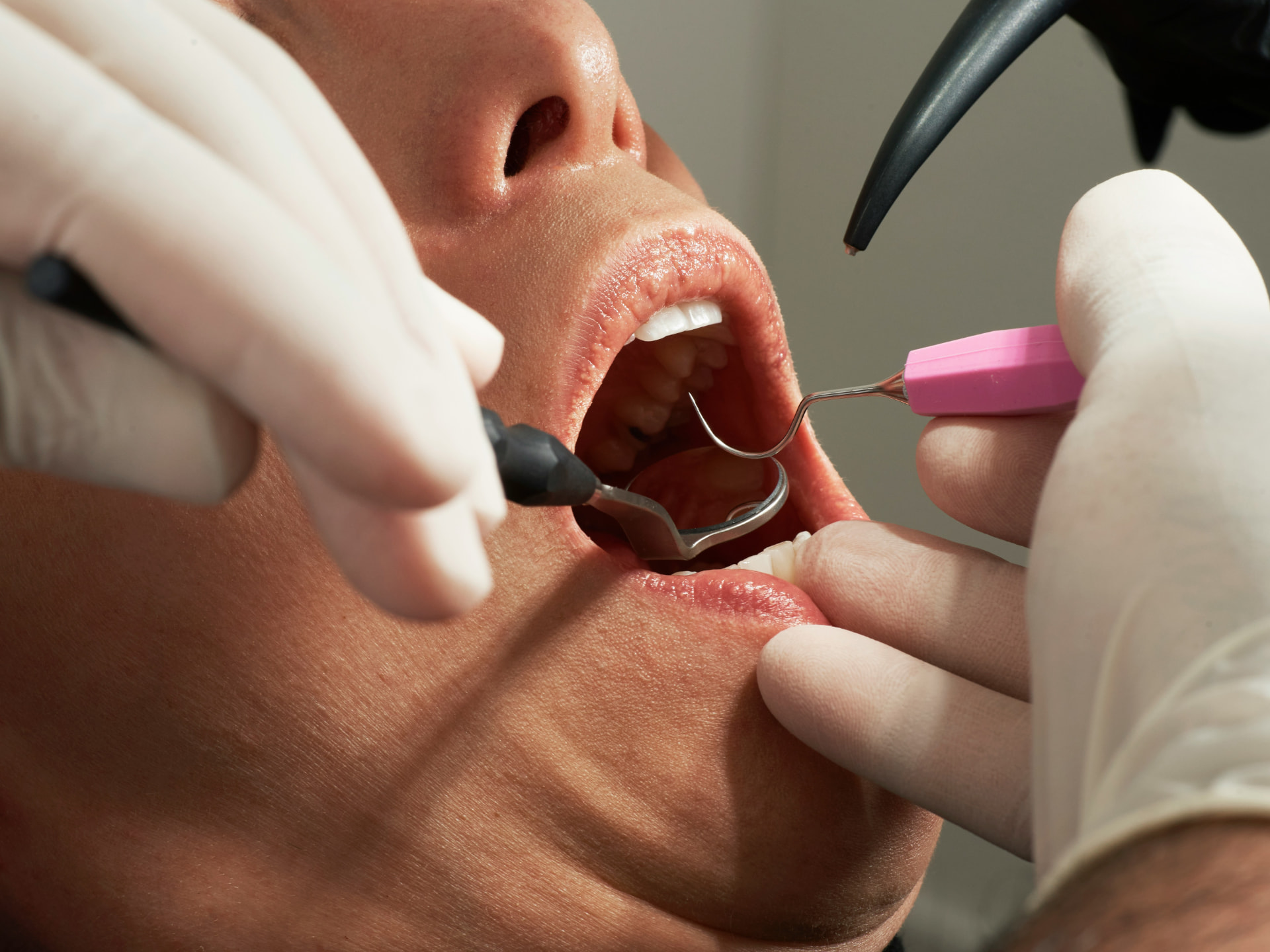 General Dentistry at Westmount Dental