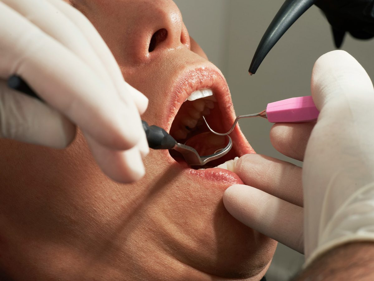 General Dentistry at Westmount Dental