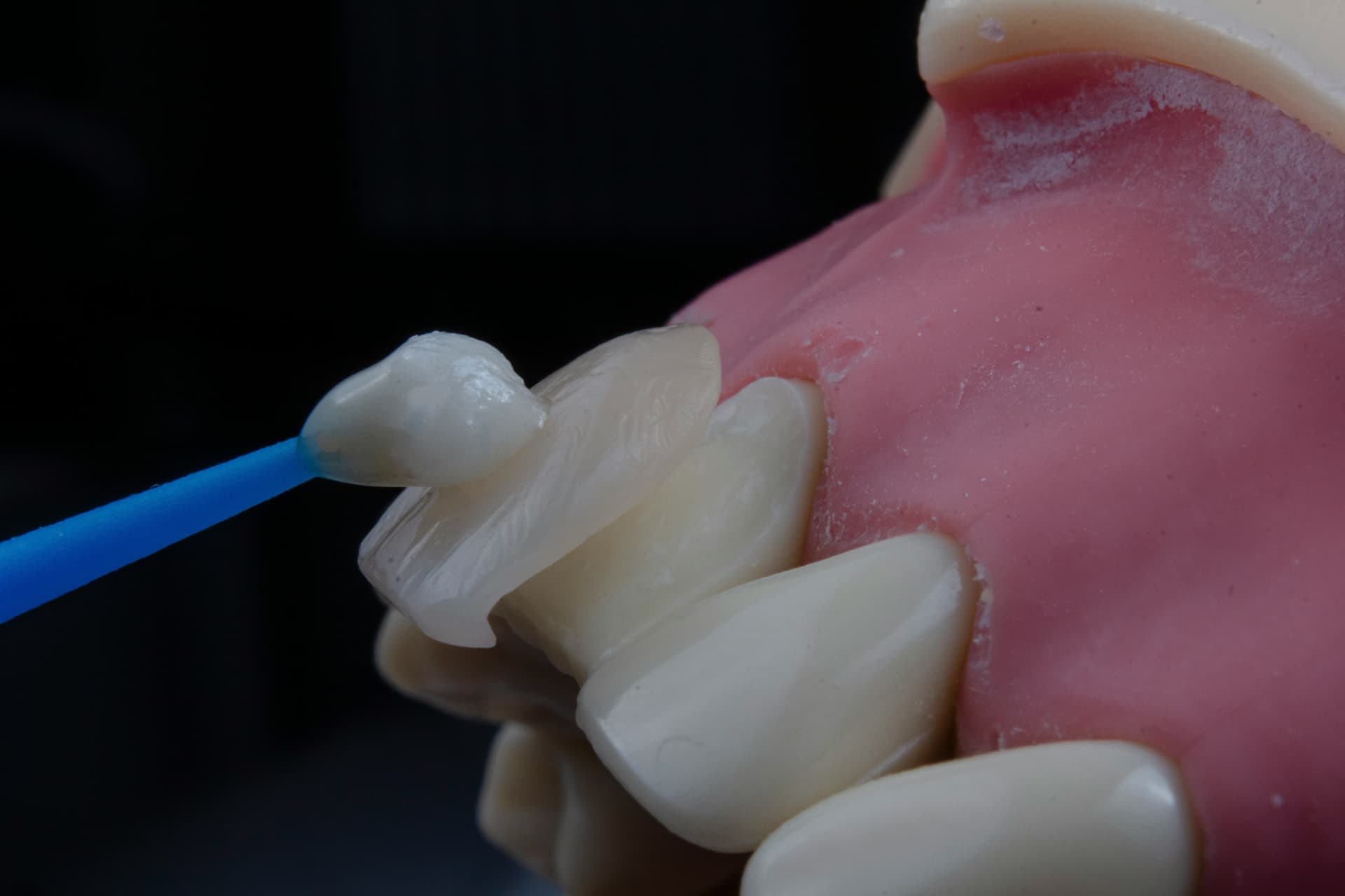 Cosmetic Dentistry at Westmount Dental