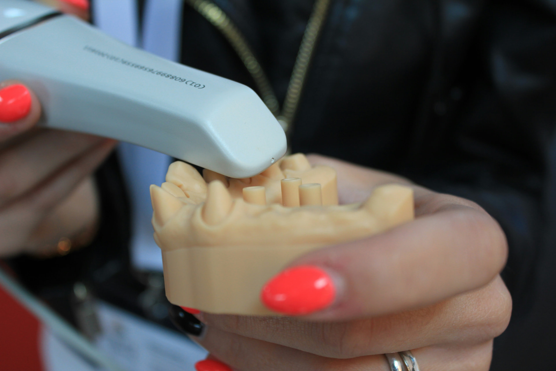 Digital Scanner at Westmount Dental in Waterloo